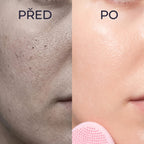 Detail pleti před používáním a po používání padu Kōji Glovi
