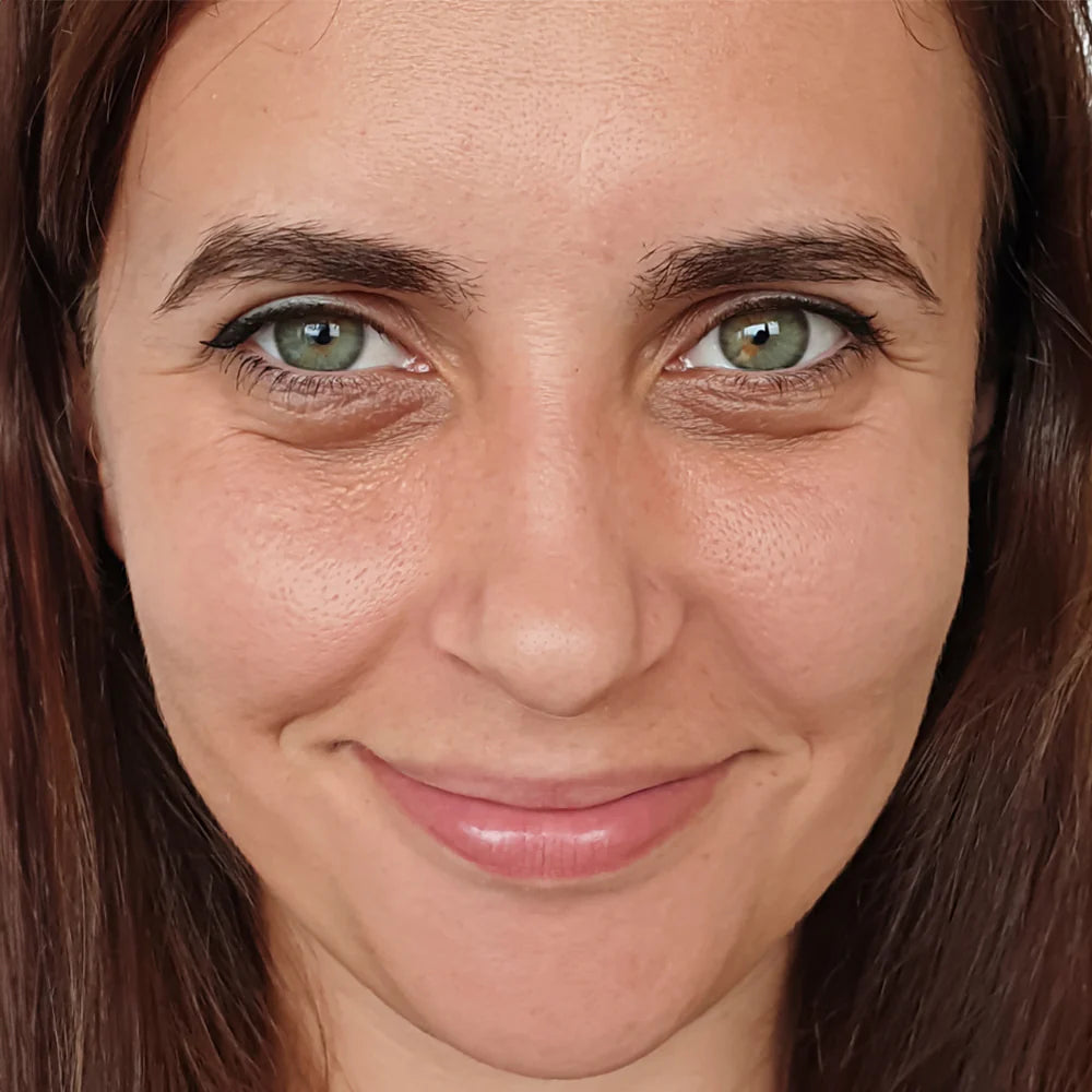 Pleť na tváři před používáním ručníku Kōji Face Towel – drsná a matná